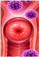 Respiratory Infections